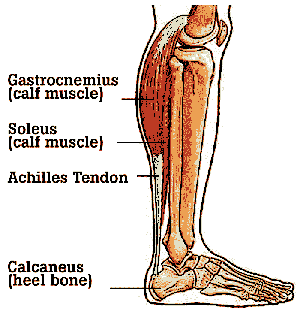 Achilles Tendinitis