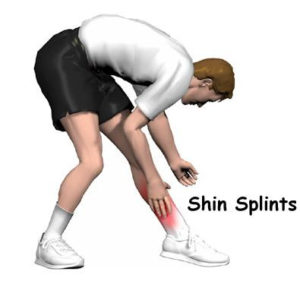 Shin Splints: Causes, Prevention and Recovery