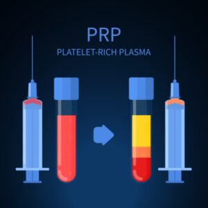 Platelet-rich Plasma (PRP) Treatment for Common Sports Injuries
